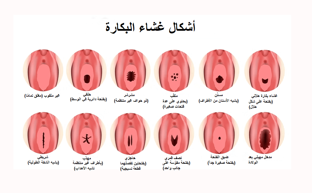 علامات تدل على وجود غشاء البكارة (2)