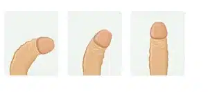 شكل العضو الذكري